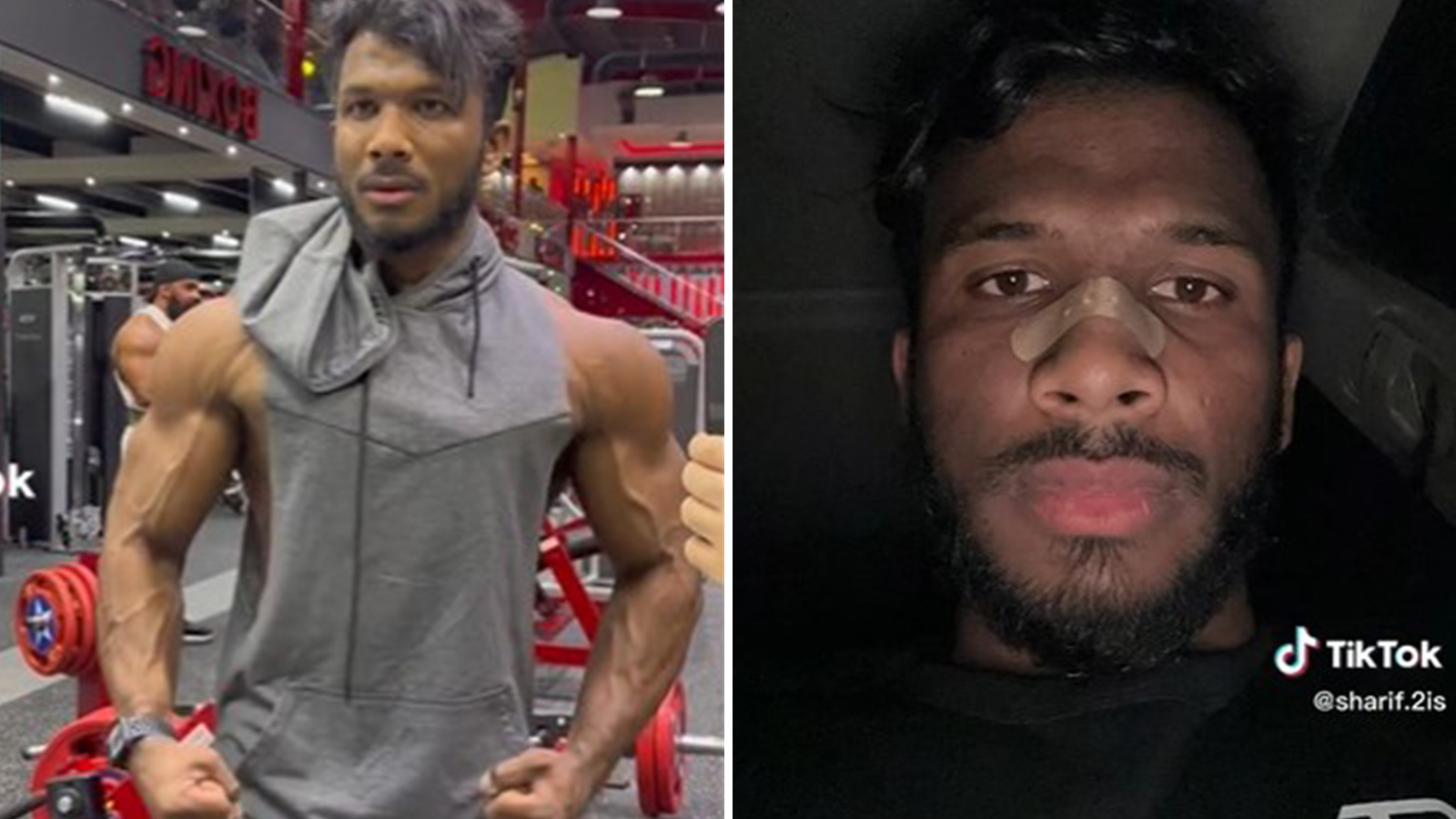 TikToker breaks nose after passing out at gym from flexing too hard 67